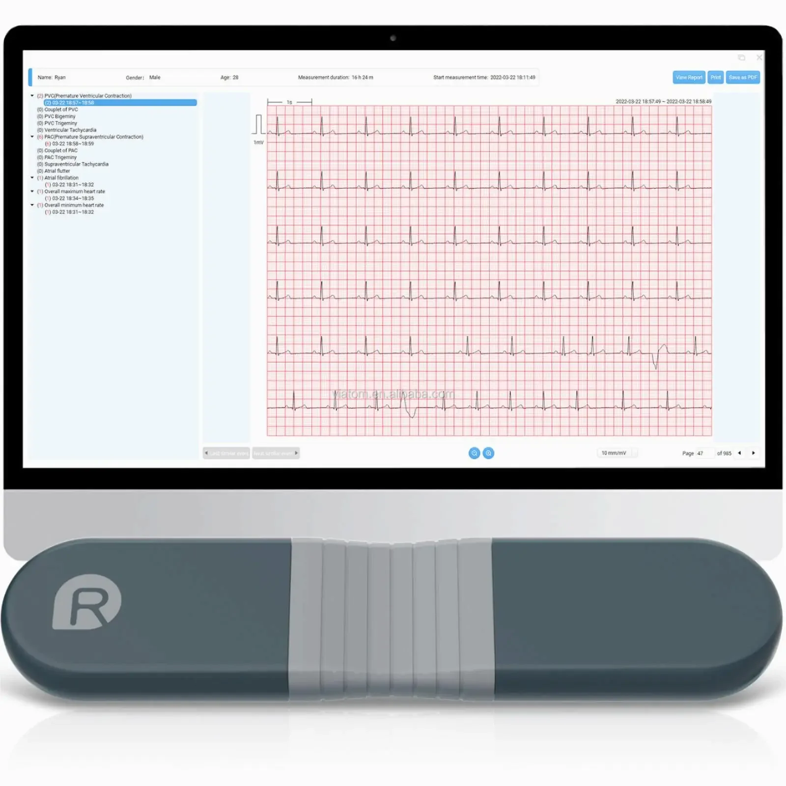 Registratore dinamico Bluetoot - Ecg Patch Monitor recensione e prezzo